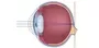 Hyperopia Ophthalmologist In New Castle Johannesburg Dr Junaid Zondi Sa Hyperopia Ophthalmologist In New Castle Johannesburg Dr Junaid Zondi Sa
